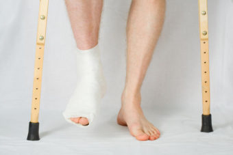 Ankle Fractures