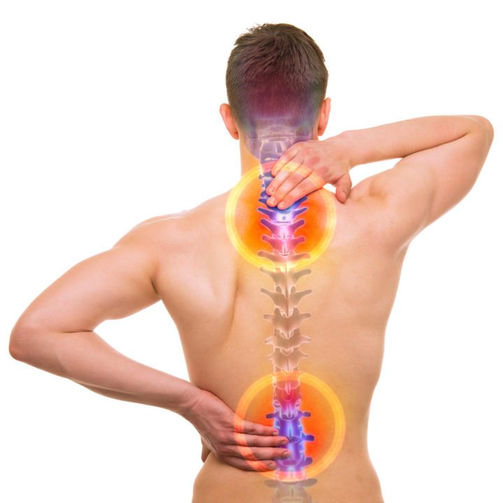 Back Pain Causes and Treatment – #4 Spinal Osteoarthritis